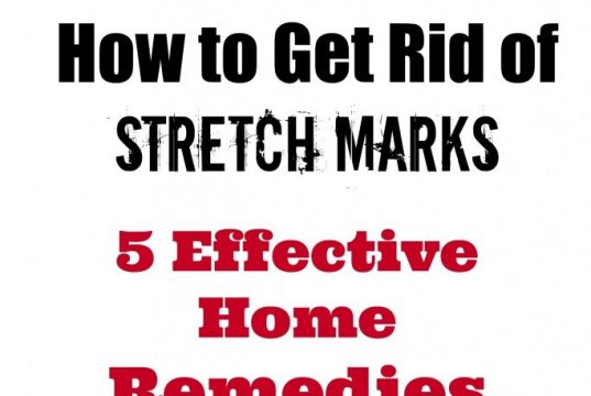 how-to-get-rid-of-stretch-marks